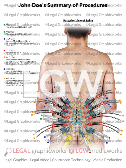 Summary of Procedures