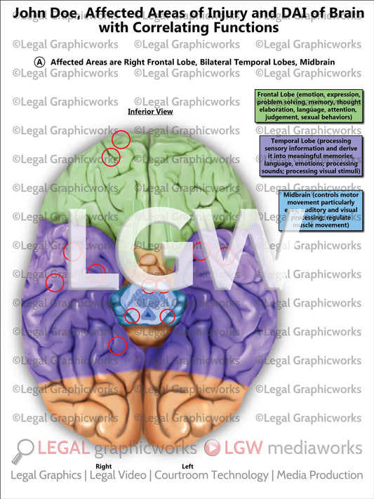 Affected Areas of Injury and DAI of Brain with Correlating Functions