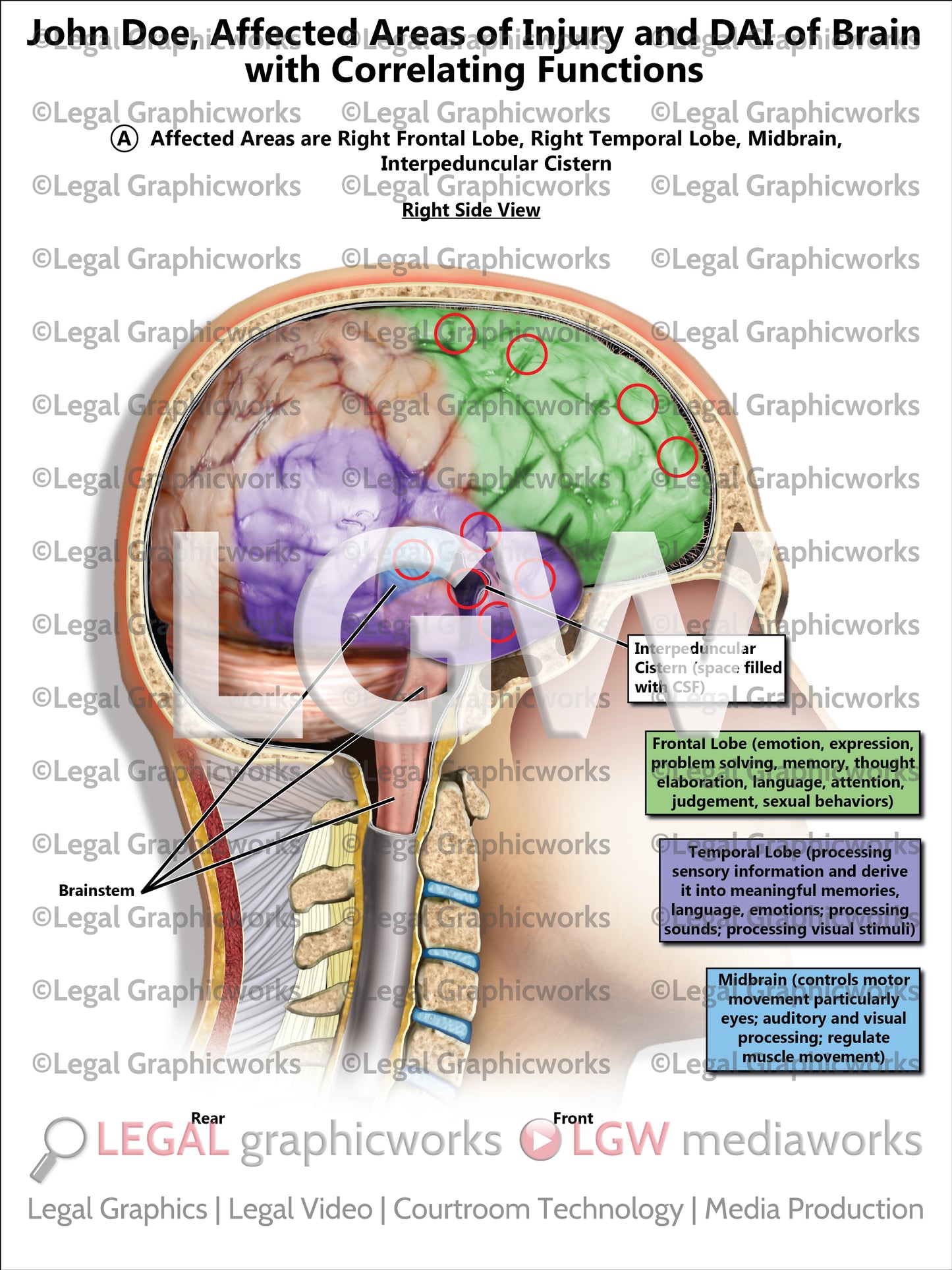 Affected Areas of Injury and DAI of Brain with Correlating Functions