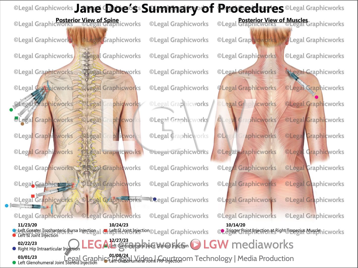 Summary of Procedures