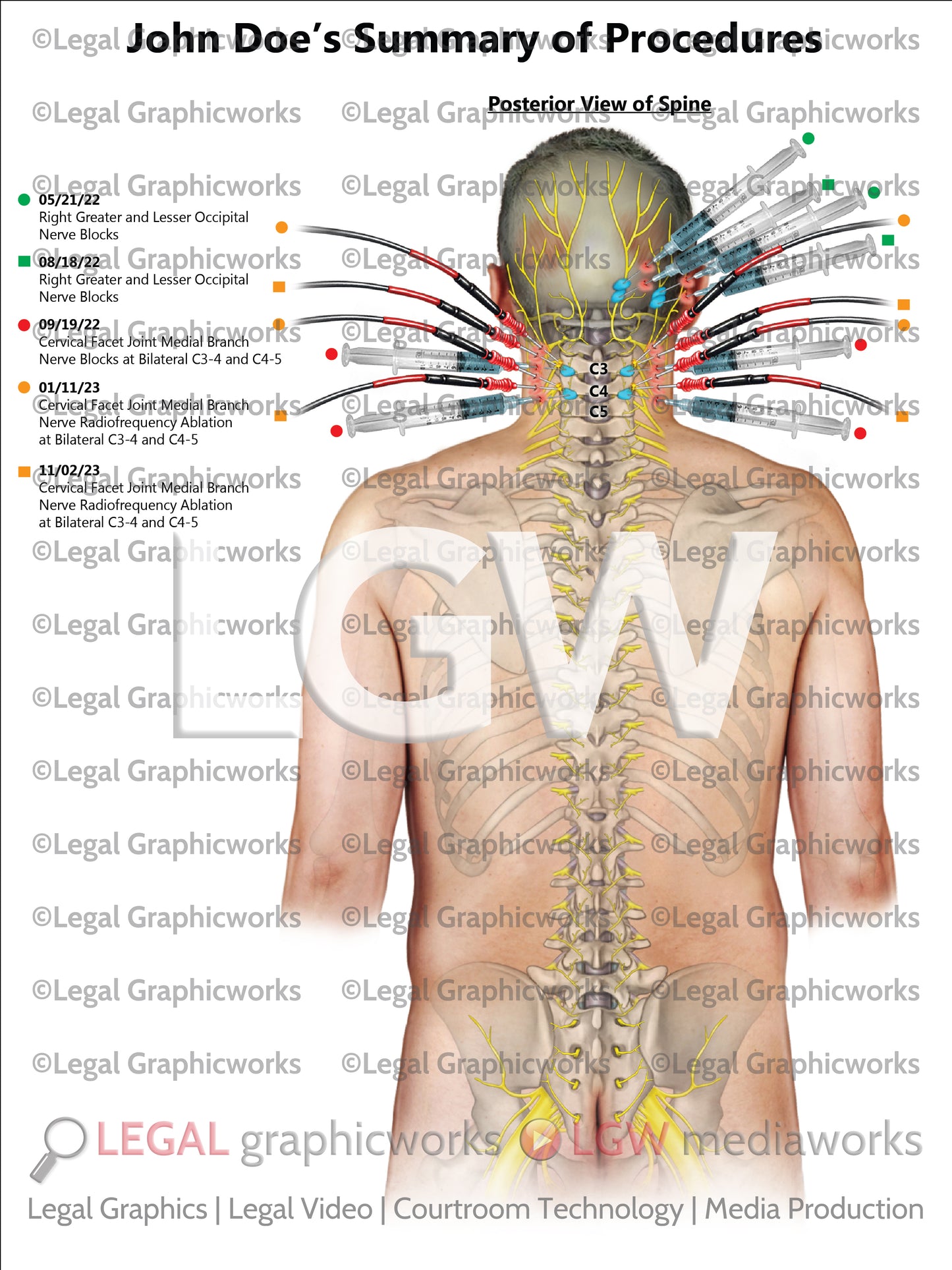Summary of Procedures