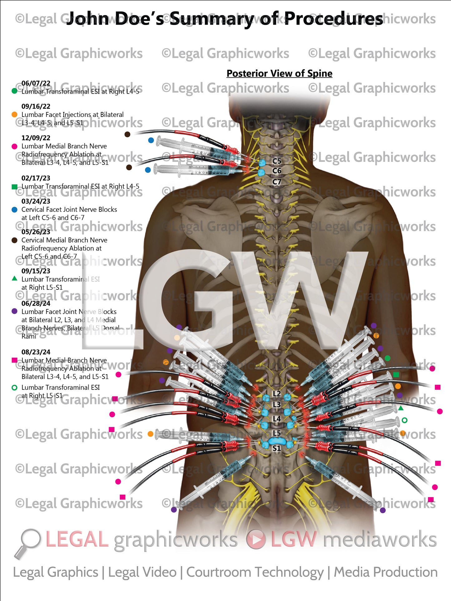 Summary of Procedures