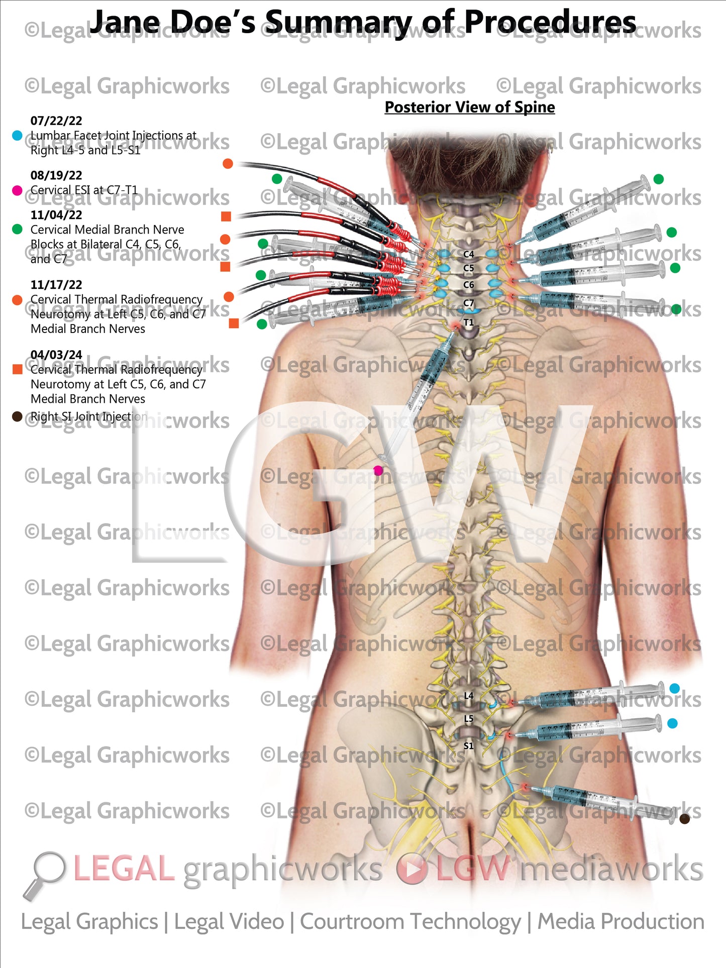 Summary of Procedures