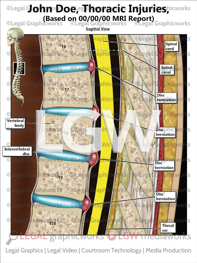 Thoracic Spine