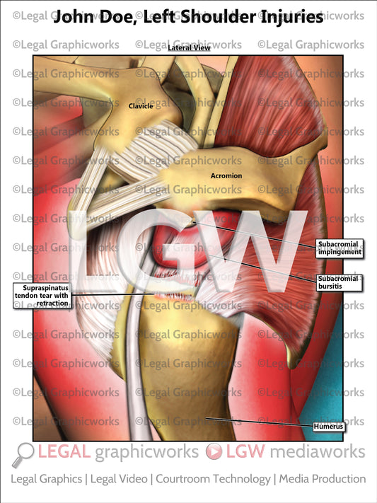 Left Shoulder Injuries