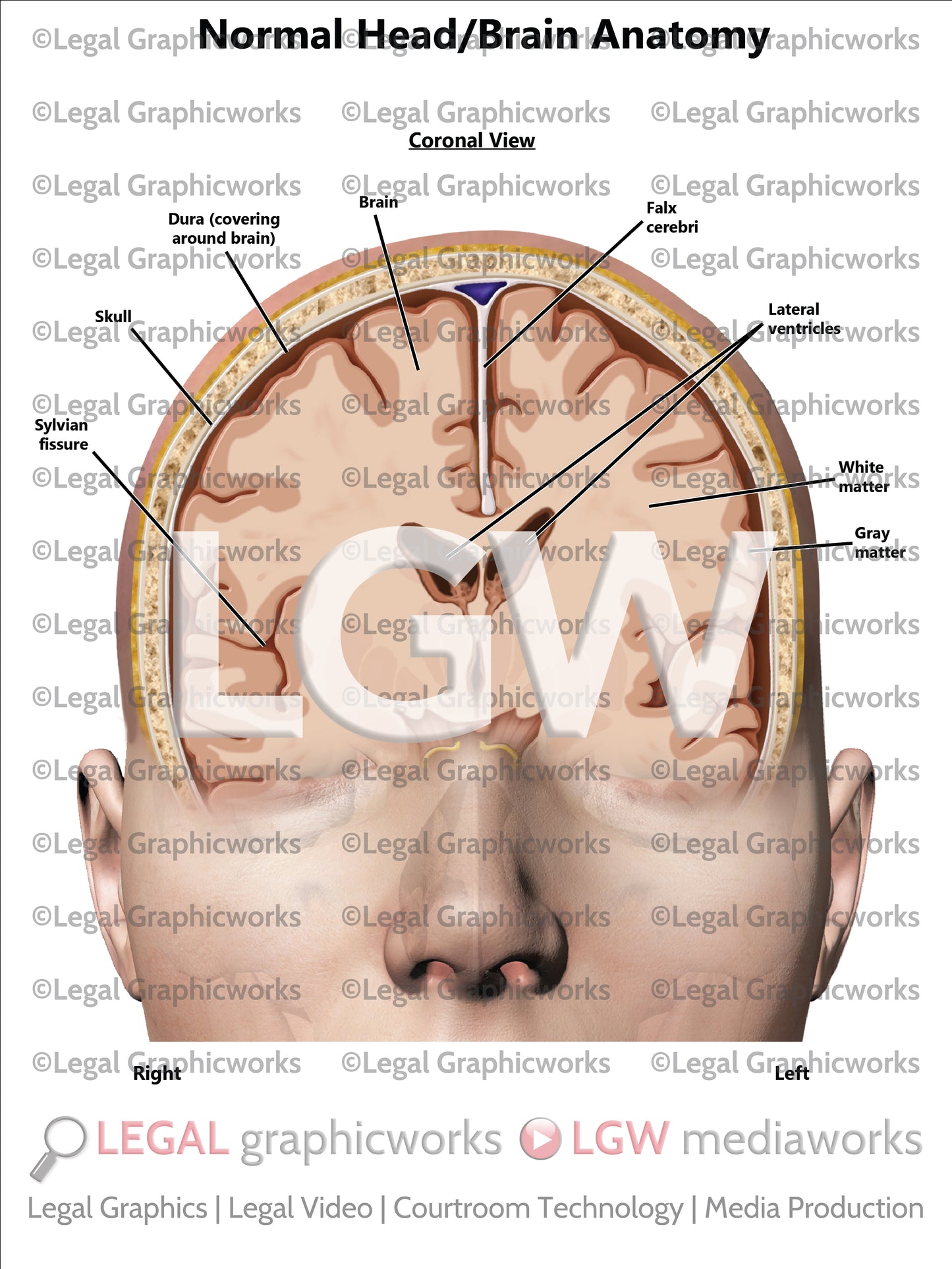 Normal Head/Brain Anatomy