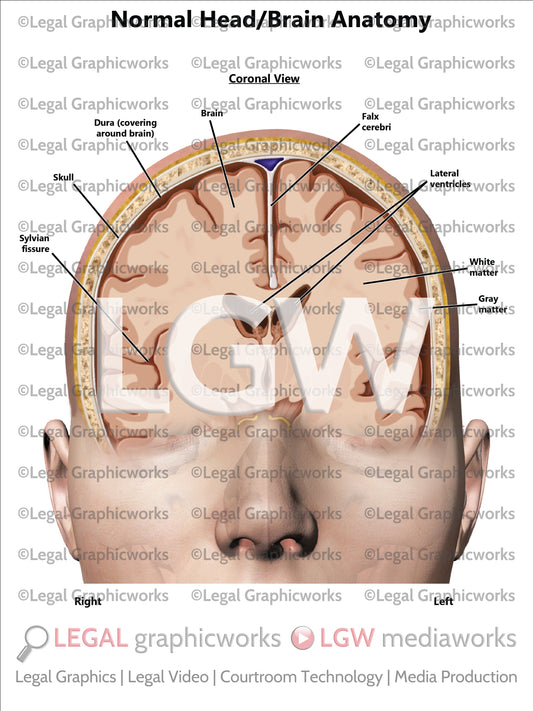Normal Head/Brain Anatomy