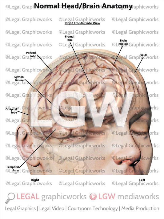 Normal Head/Brain Anatomy