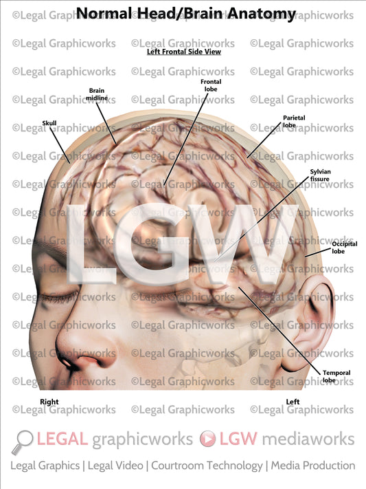Normal Head/Brain Anatomy