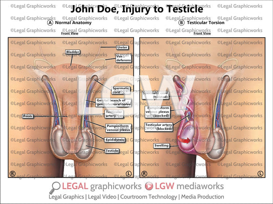 Injury to Testicle