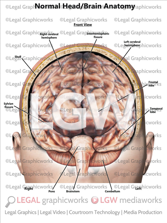 Normal Head/Brain Anatomy