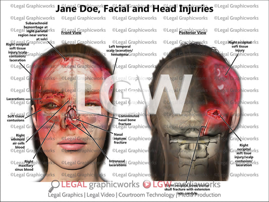 Facial and Head Injuries