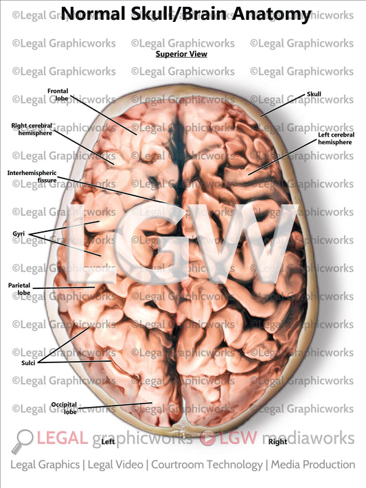 Normal Skull/Brain Anatomy