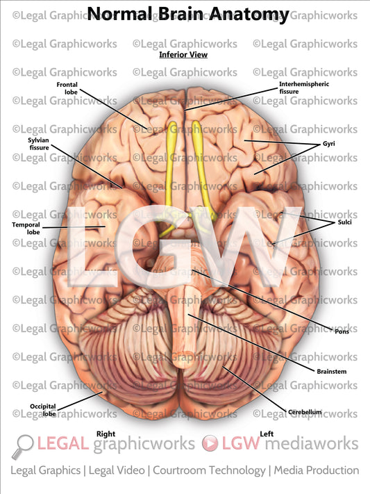Normal Brain Anatomy