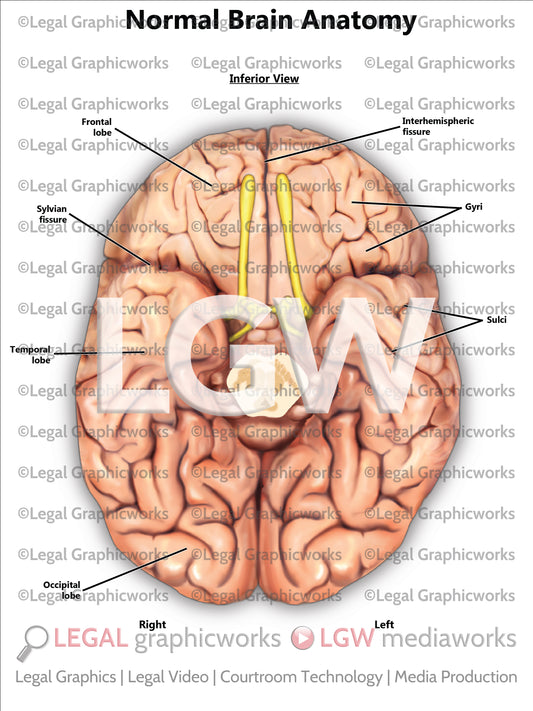 Normal Brain Anatomy