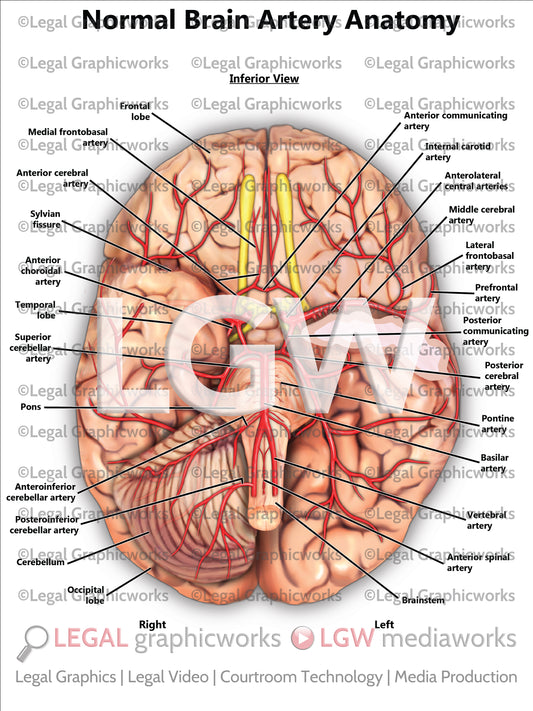 Normal Brain Artery Anatomy