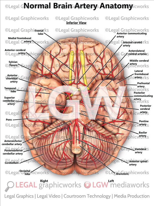 Normal Brain Artery Anatomy