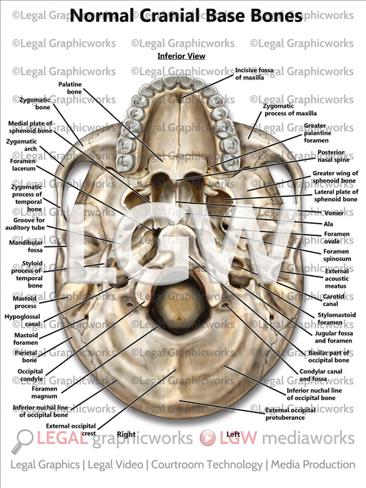 Normal Cranial Base Bones