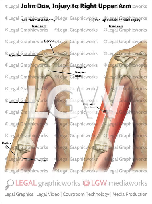 Injury to Right Upper Arm