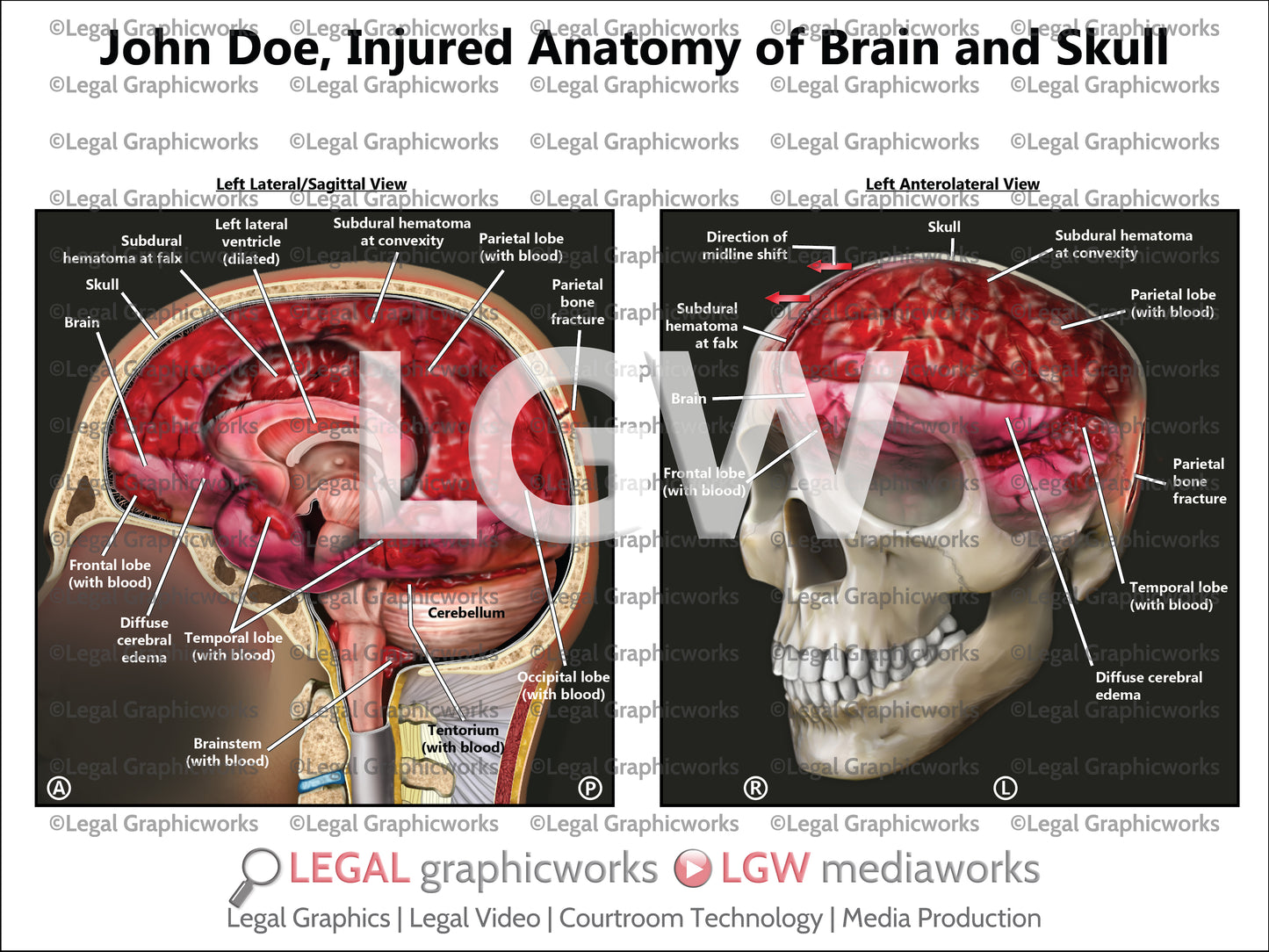 Injured Anatomy of Brain and Skull