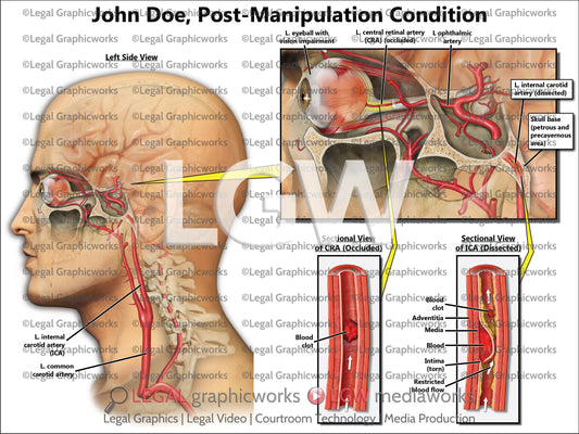 Post-Manipulation Condition