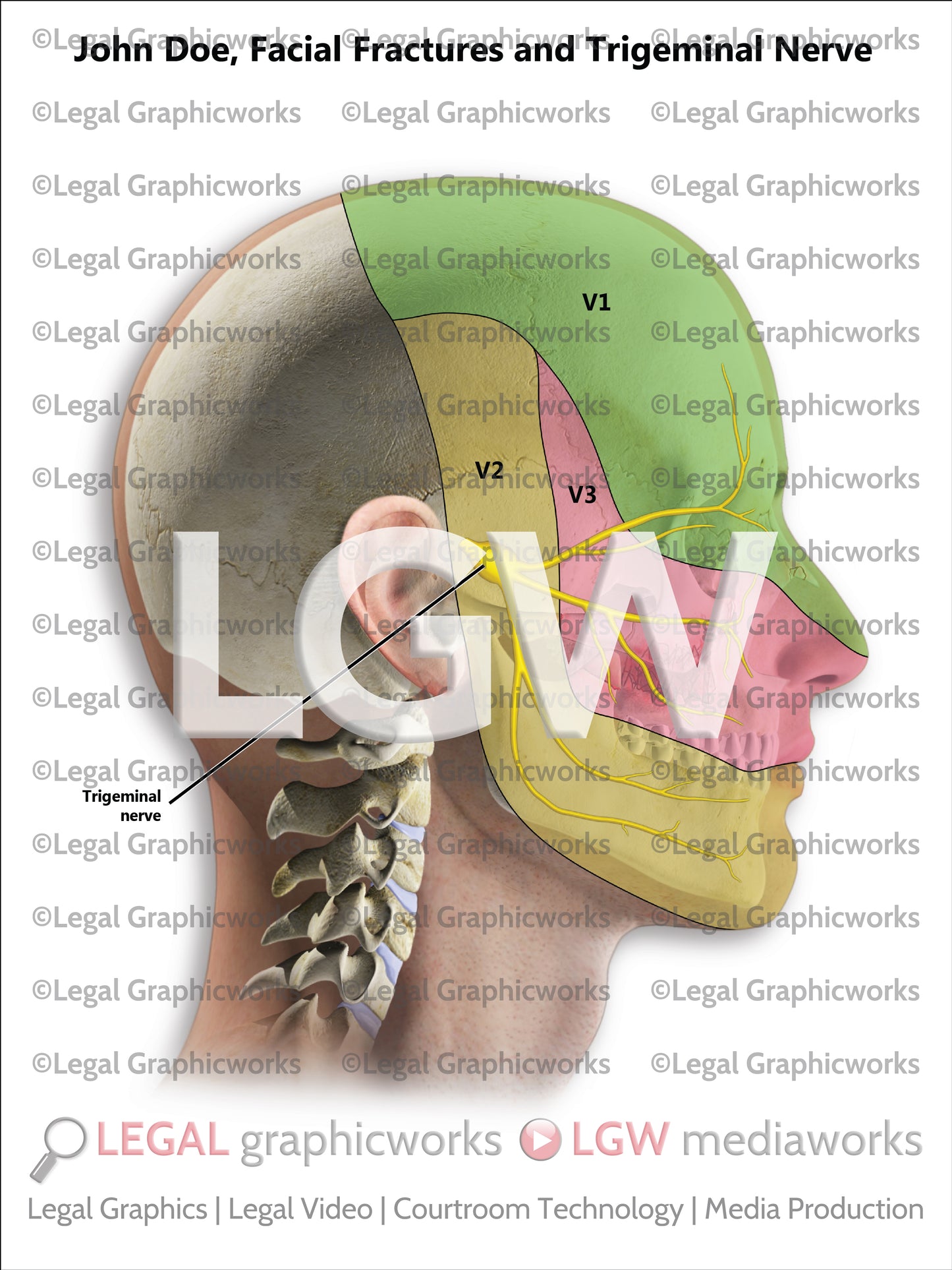 Facial Fractures and Trigeminal Nerve
