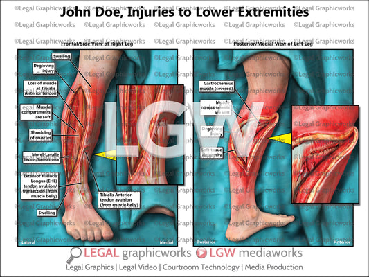 Injuries to Lower Extremities