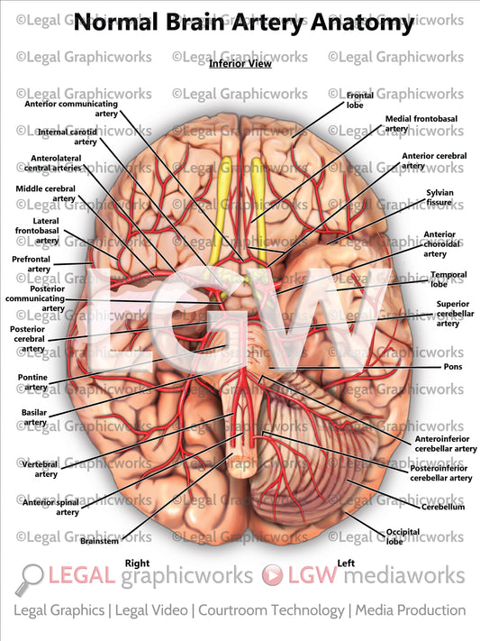 Normal Brain Artery Anatomy