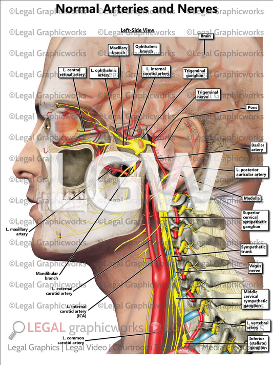 Normal Arteries and Nerves