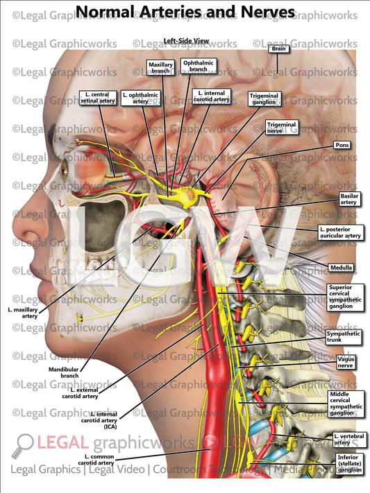 Normal Arteries and Nerves