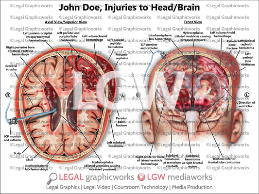 Injuries to Head/Brain