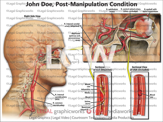 Post-Manipulation Condition