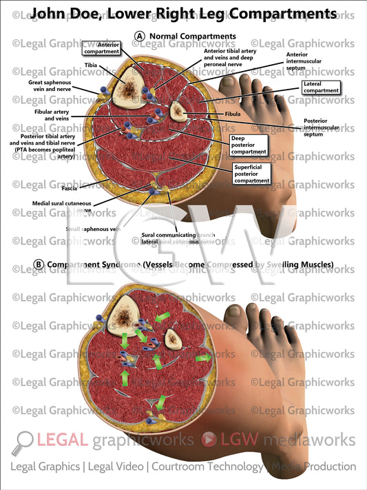 Lower Right Leg Compartments