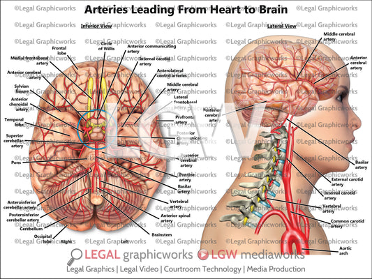 Arteries Leading From Heart to Brain