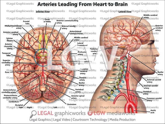 Arteries Leading From Heart to Brain