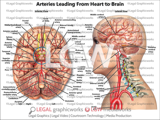 Arteries Leading From Heart to Brain