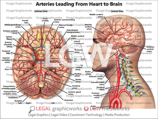 Arteries Leading From Heart to Brain