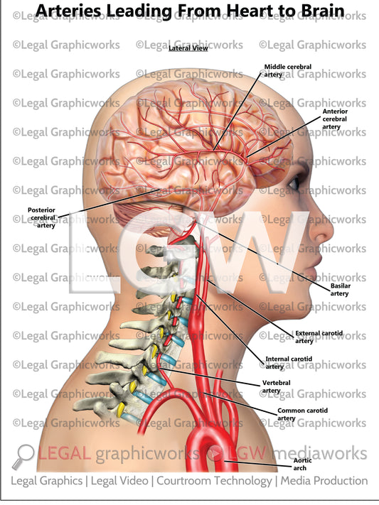Arteries Leading From Heart to Brain