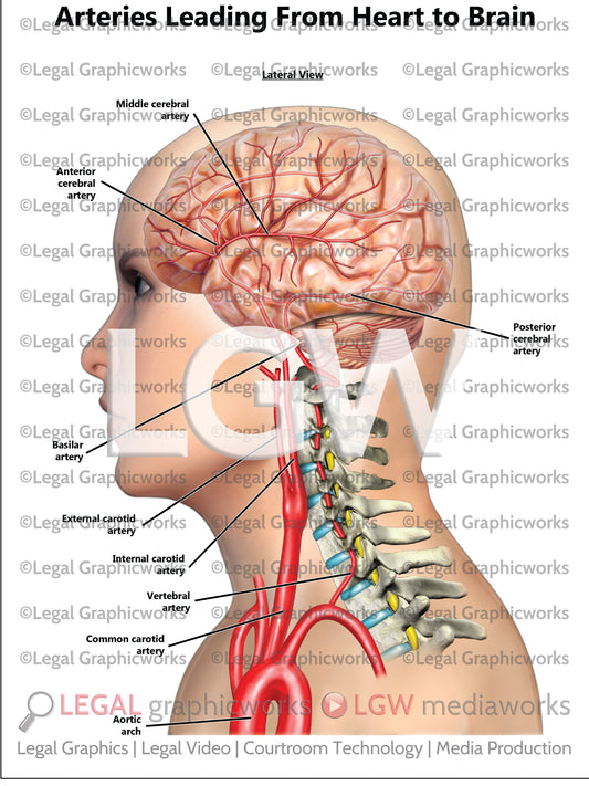 Arteries Leading From Heart to Brain