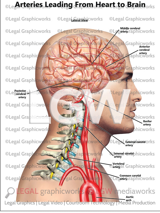 Arteries Leading From Heart to Brain