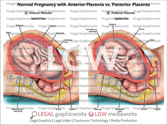 Normal Pregnancy with Anterior Placenta vs. Posterior Placenta