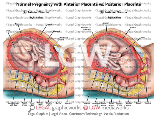 Normal Pregnancy with Anterior Placenta vs. Posterior Placenta