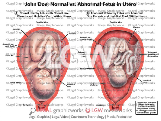Normal vs. Abnormal Fetus in Utero