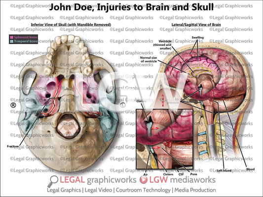 Injuries to Brain and Skull