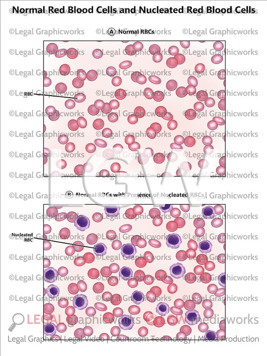 Normal Red Blood Cells and Nucleated Red Blood Cells