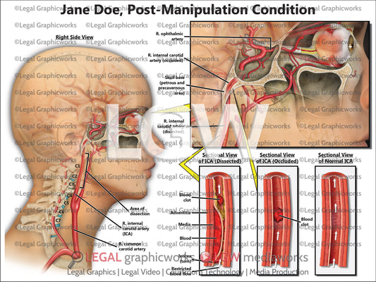 Post-Manipulation Condition