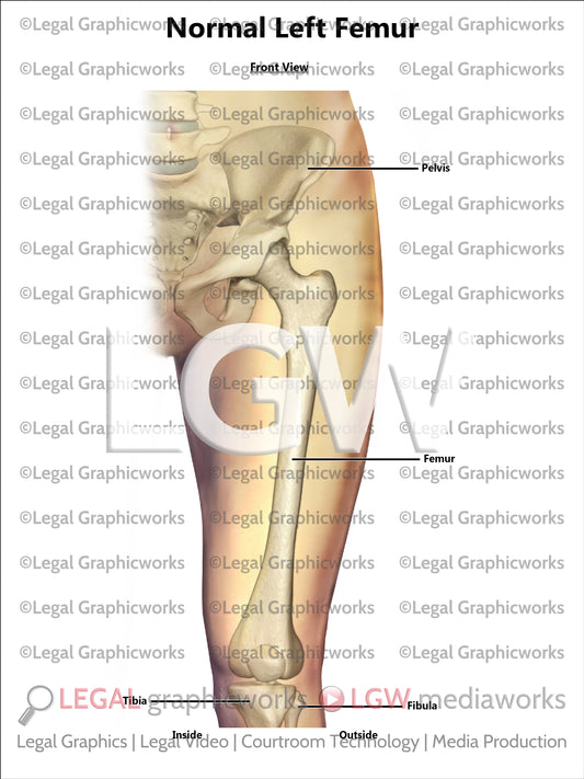 Normal Left Femur