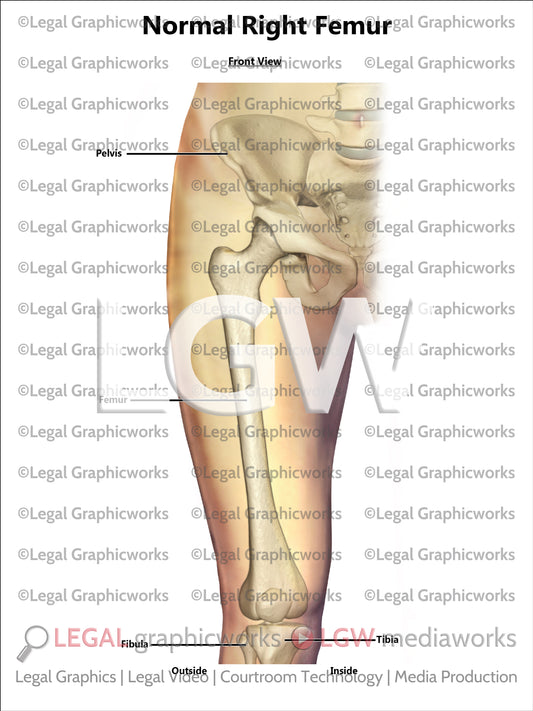 Normal Right Femur