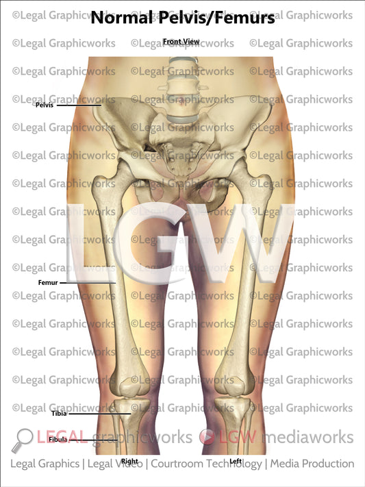 Normal Pelvis/Femurs