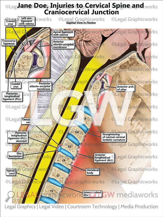 Injuries to Cervical Spine and Craniocervical Junction
